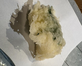 Dinner at Tempura Asanuma (天ぷら浅沼)