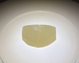Dinner at Trace (トレイス)